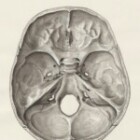 What Is Post-Concussion Syndrome And How Long Does It Last?